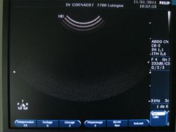 echographie vetofora